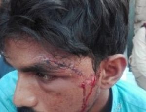 Pakistani Christian man burnt with iron for befriending Muslim woman